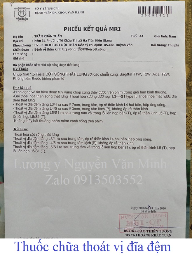 Thuốc chữa thoát vị địa đệm